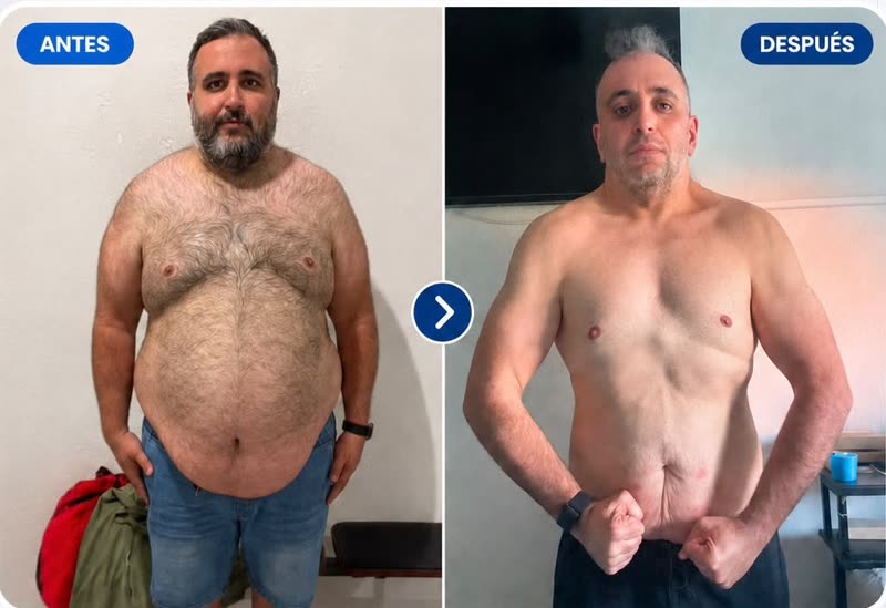 Antes y después - paciente Biopept Life